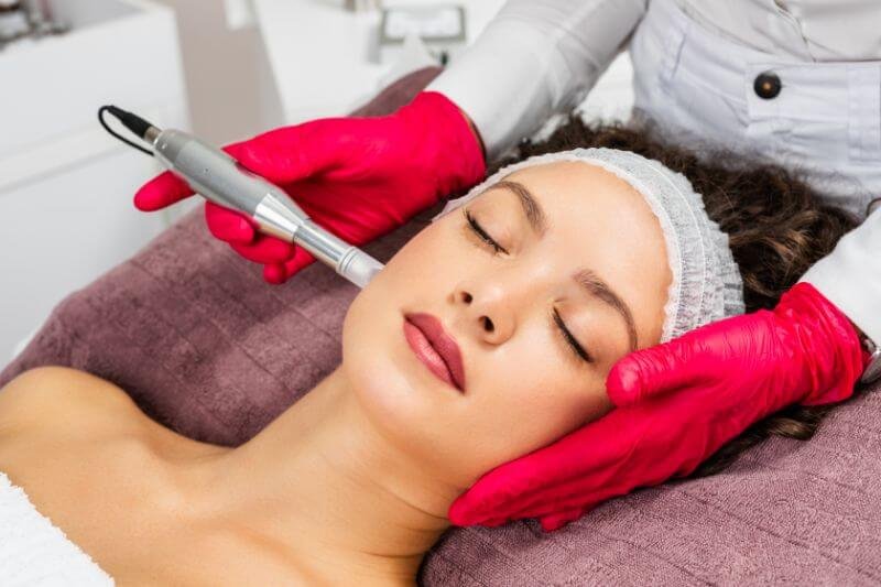 Microneedling Benefits: A Review and Guide